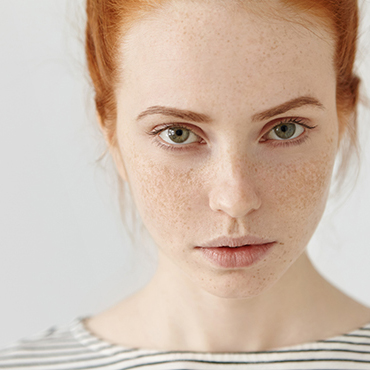 Wie macht man Sommersprossen? Mini-Schritt-für-Schritt-Anleitung